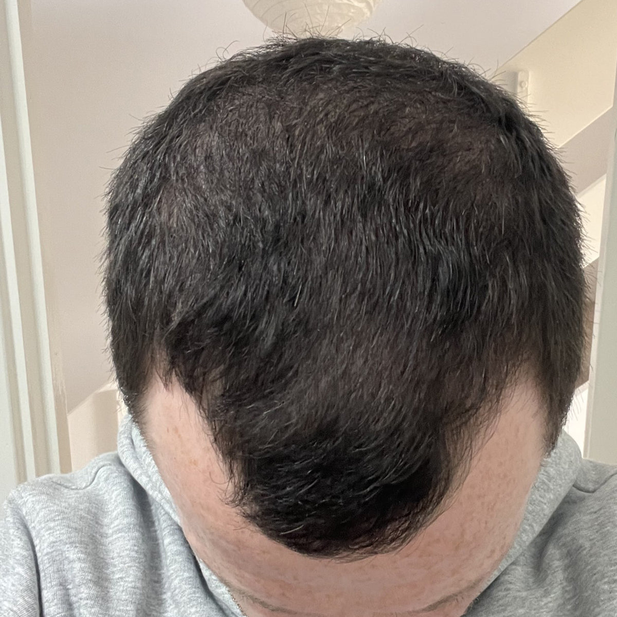 After