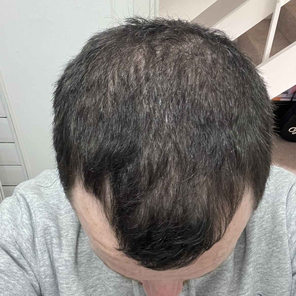 Before